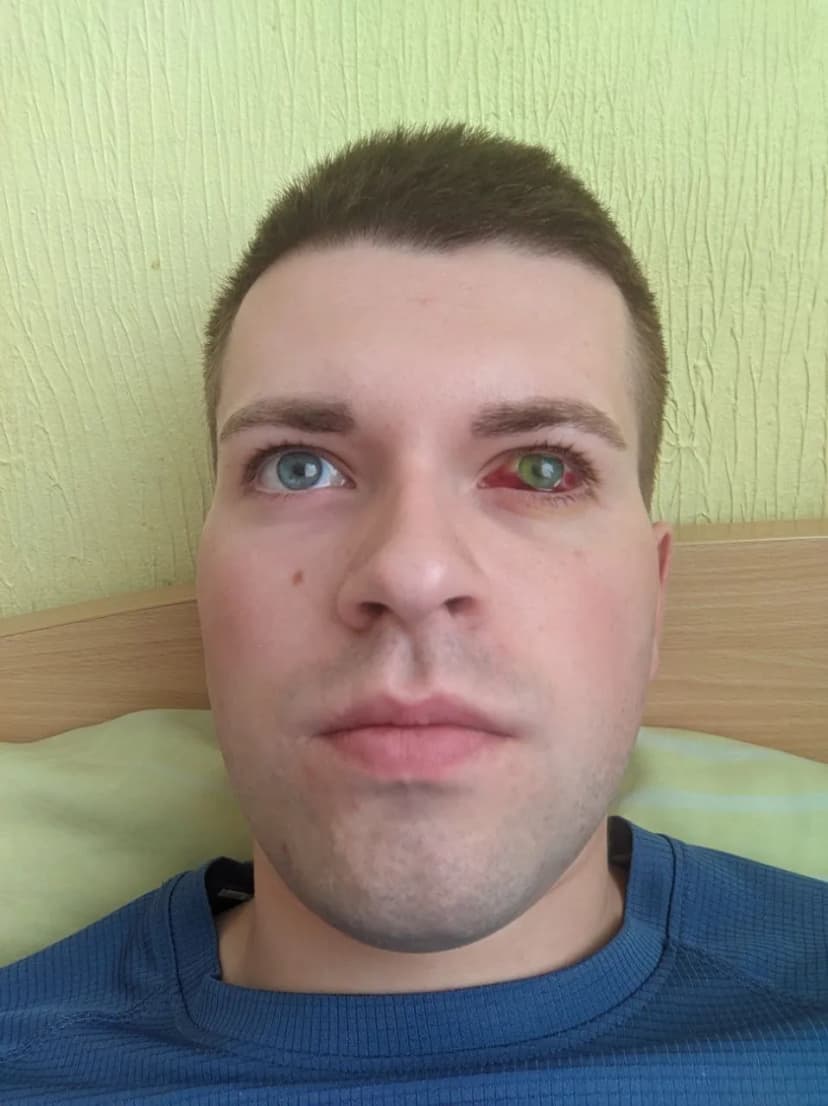 Пошкоджене око